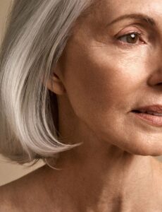 Ετών 40 & Botox / Πηγή: Pinterest.com